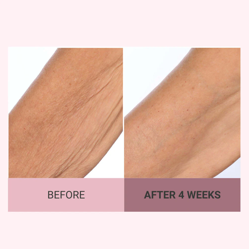 💆♀️ Experience Ultimate Luxury - 50% OFF - ✨ Champagne Beaute Lift Firming Body Crème - For Firmer, Smoother, Radiant Skin! 🌟(Buy 3 & Free Shipping)
