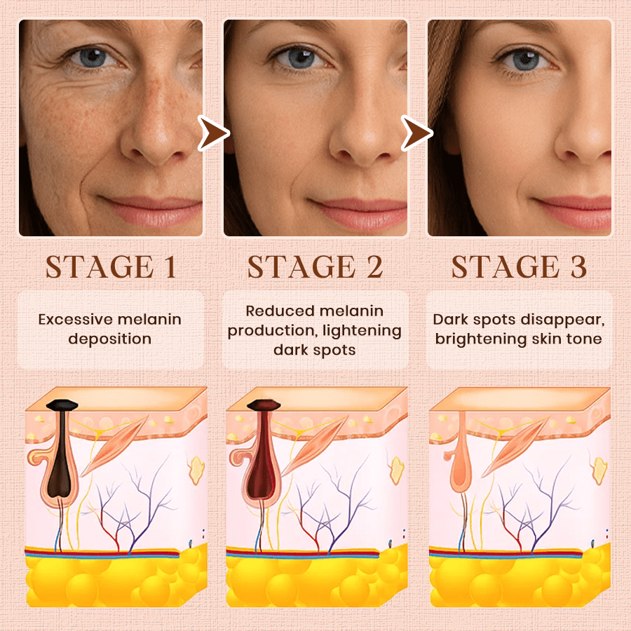 𝐂𝐯𝐫𝐞𝐨𝐳® Purifying Exfoliating Gel for Acanthosis Nigricans, Exfoliation, Dark Spots, Skin Tags, and Eczema_Ultra01