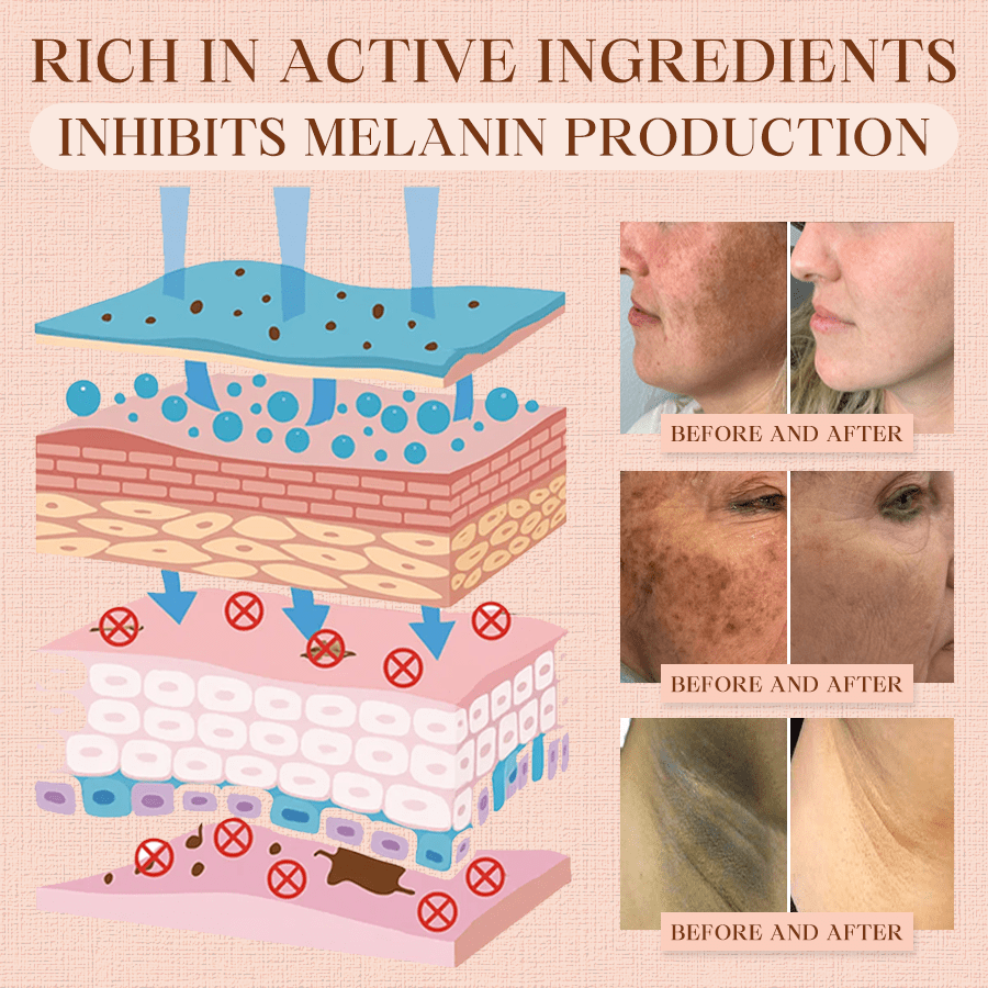 𝐂𝐯𝐫𝐞𝐨𝐳® Purifying Exfoliating Gel for Acanthosis Nigricans, Exfoliation, Dark Spots, Skin Tags, and Eczema_Ultra01