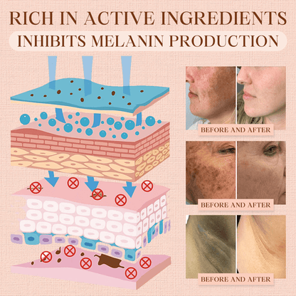 𝐂𝐯𝐫𝐞𝐨𝐳® Purifying Exfoliating Gel for Acanthosis Nigricans, Exfoliation, Dark Spots, Skin Tags, and Eczema_Ultra01
