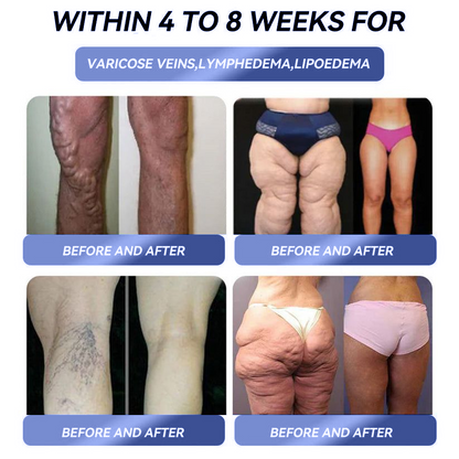 𝑶𝒇𝒇𝒊𝒄𝒊𝒂𝒍 𝑺𝒕𝒐𝒓𝒆 |𝐂𝐯𝐫𝐞𝐨𝐳®𝟏𝟒-𝐢𝐧-𝟏 𝐌𝐚𝐠𝐧𝐞𝐬𝐢𝐮𝐦 𝐆𝐮𝐦𝐦𝐢𝐞𝐬(𝐉𝐮𝐬𝐭 𝐨𝐧𝐜𝐞 𝐚 𝐝𝐚𝐲, 𝐯𝐢𝐬𝐢𝐛𝐥𝐞 𝐜𝐡𝐚𝐧𝐠𝐞𝐬 𝐢𝐧 𝟕 𝐝𝐚𝐲𝐬)𝐅𝐨𝐫 𝐨𝐛𝐞𝐬𝐢𝐭𝐲, 𝐜𝐚𝐫𝐝𝐢𝐨𝐯𝐚𝐬𝐜𝐮𝐥𝐚𝐫 𝐡𝐞𝐚𝐥𝐭𝐡, 𝐝𝐢𝐚𝐛𝐞𝐭𝐞𝐬, 𝐬𝐥𝐞𝐞𝐩 𝐚𝐩𝐧𝐞𝐚, 𝐆𝐮𝐭 𝐇𝐞𝐚𝐥𝐭𝐡, 𝐣𝐨𝐢𝐧𝐭 𝐢𝐬𝐬𝐮𝐞𝐬, 𝐚𝐧𝐝 𝐦𝐨𝐫𝐞