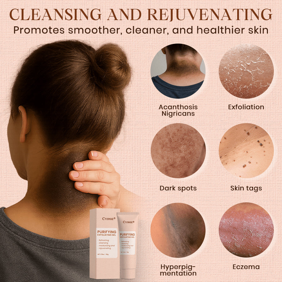 𝐂𝐯𝐫𝐞𝐨𝐳® Purifying Exfoliating Gel for Acanthosis Nigricans, Exfoliation, Dark Spots, Skin Tags, and Eczema_Ultra01