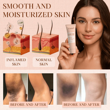 𝐂𝐯𝐫𝐞𝐨𝐳® Purifying Exfoliating Gel for Acanthosis Nigricans, Exfoliation, Dark Spots, Skin Tags, and Eczema_Ultra01