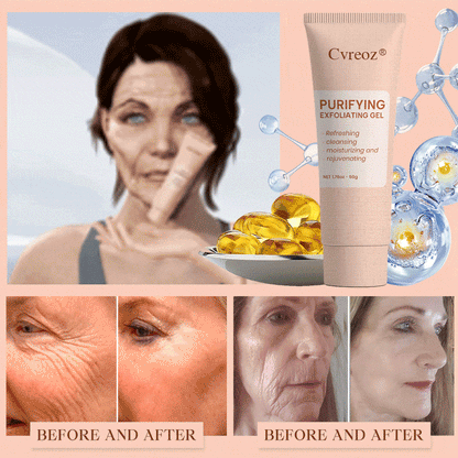 𝐂𝐯𝐫𝐞𝐨𝐳® Purifying Exfoliating Gel for Acanthosis Nigricans, Exfoliation, Dark Spots, Skin Tags, and Eczema_Ultra01