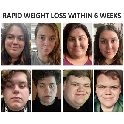 GLP-1 Patches🎉 - Slimming, Skin Tightening, Blood Sugar Support, No Injection, 7- Day Result